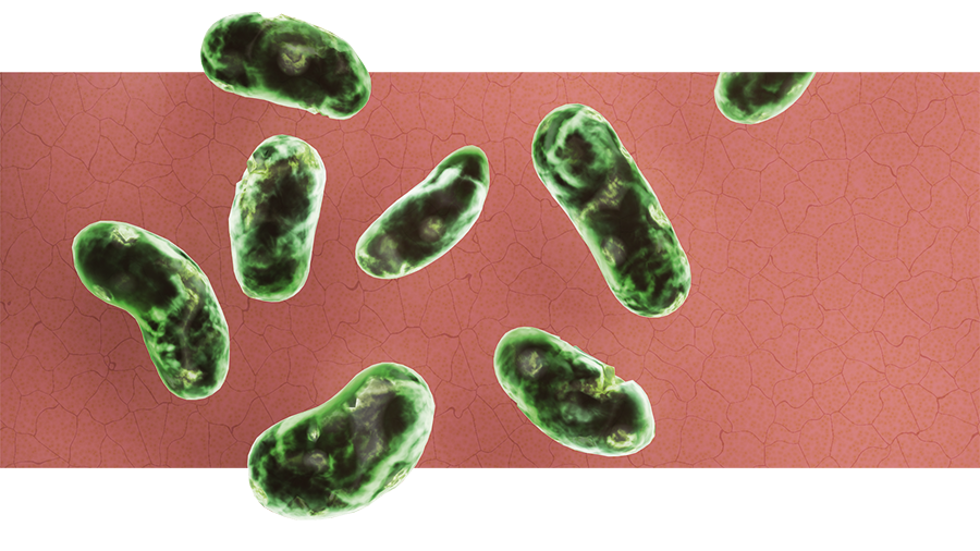 2. Farbstoff wird durch die Bakterien aufgenommen, nicht durch die menschliche Zelle – Kein Antibiotikum notwendig